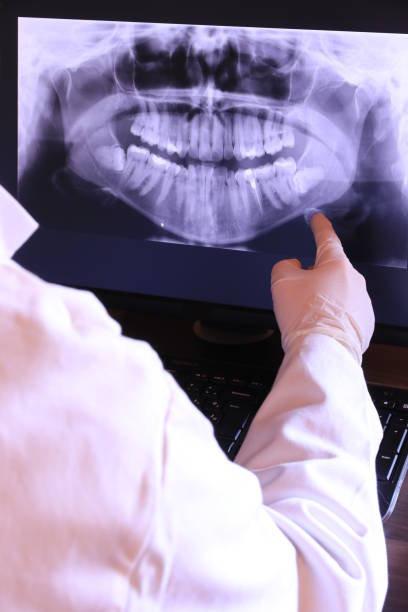 Best Emergency Wisdom Teeth Removal in Kannapolis, NC